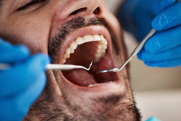 Emergency Dentist for Special Needs Patients